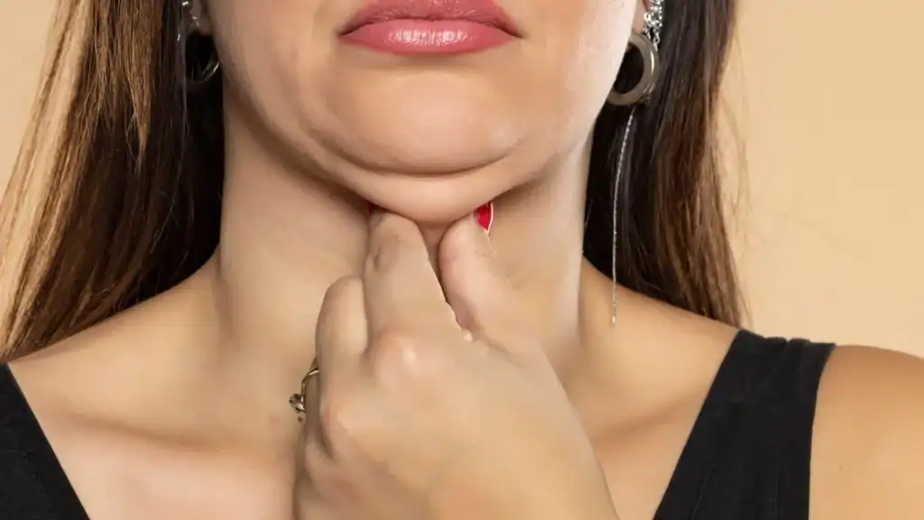 An image of a woman with double chin, sad, worried : Non Surgical Double Chin Removal Treatment in Barr Common, UK