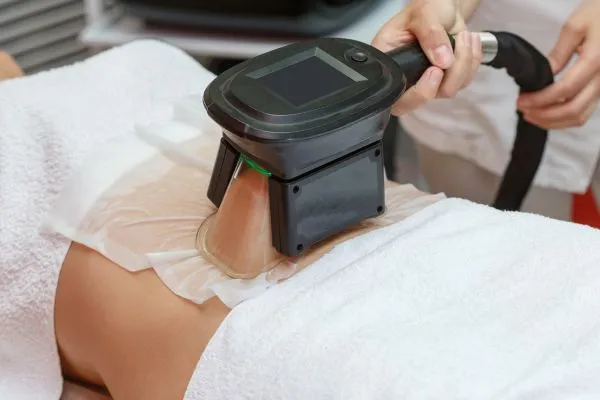 Image of person having fat freezing treatment to help weight gain Barr Common